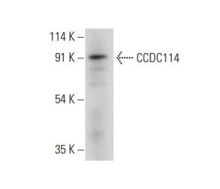 CCDC114 Antibody (C-1) - Western Blotting - Image 308121 