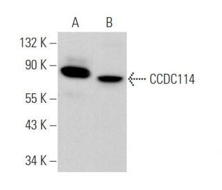 CCDC114 Antibody (E-8) - Western Blotting - Image 375954 