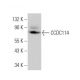 CCDC114 Antibody (E-8) - Western Blotting - Image 375947