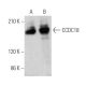 CCDC18 Antibody (G-5) - Western Blotting - Image 370136 
