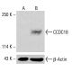CCDC18 Antibody (G-5) - Western Blotting - Image 415981