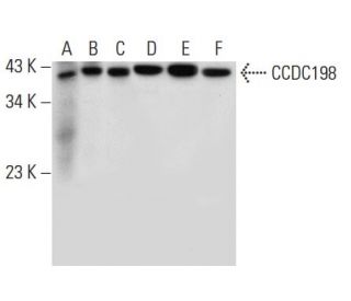 CCDC198 Antibody (B-1) - Western Blotting - Image 309526 