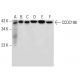 CCDC198 Antibody (B-1) - Western Blotting - Image 309526 