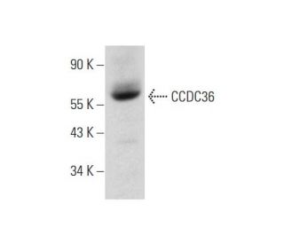 CCDC36 Antibody (B-11) - Western Blotting - Image 318428 