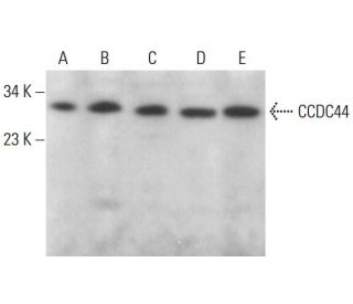 CCDC44 Antibody (D-3) - Western Blotting - Image 376227 