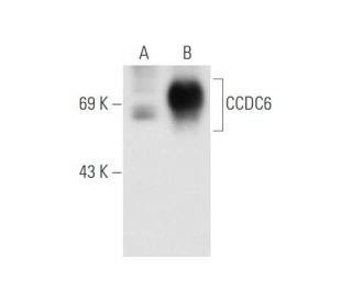 CCDC6 Antibody (Q-23) - Western Blotting - Image 58539 