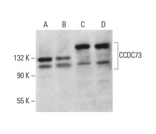 CCDC73 Antibody (D-8) - Western Blotting - Image 376622 