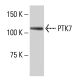 PTK7 Antibody (WW02) - Western Blotting - Image 33678