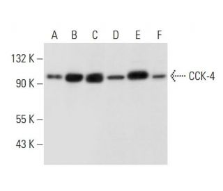 CCK-4 Antibody (WW02)