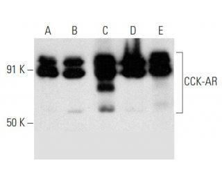 western blotting image from recommended CCK-AR (F-6) monoclonal antibody replacement. Image 358392