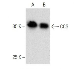 CCS Antibody (E-1) - Western Blotting - Image 357289 