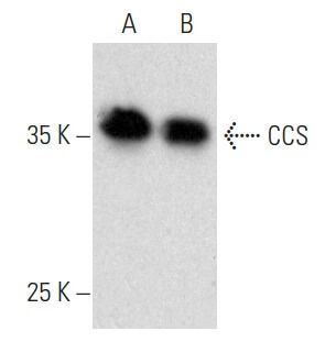 CCS Antibody E 1 SCBT Santa Cruz Biotechnology