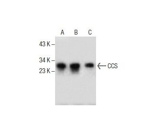 CCS Antibody (E-5) - Western Blotting - Image 285812 