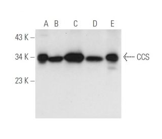 CCS Antibody (H-7) - Western Blotting - Image 14535