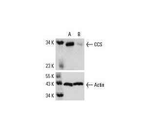 CCS siRNA (h): sc-29956. Western blot analysis of CCS expression in non-transfected control (A) and CCS siRNA transfected 
