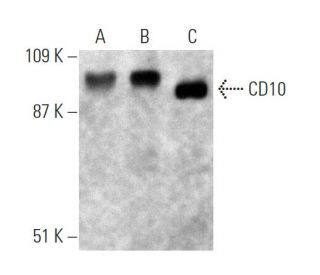 CD10 Antibody (2A1H5E1) - Western Blotting - Image 372292 