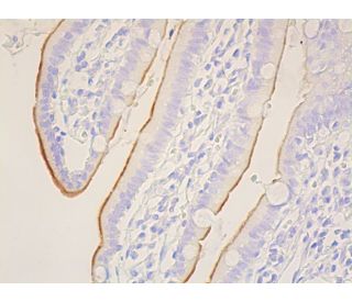 CD10 Antibody (F-4) | SCBT - Santa Cruz Biotechnology