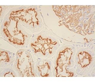 CD10 Antibody (F-4) | SCBT - Santa Cruz Biotechnology