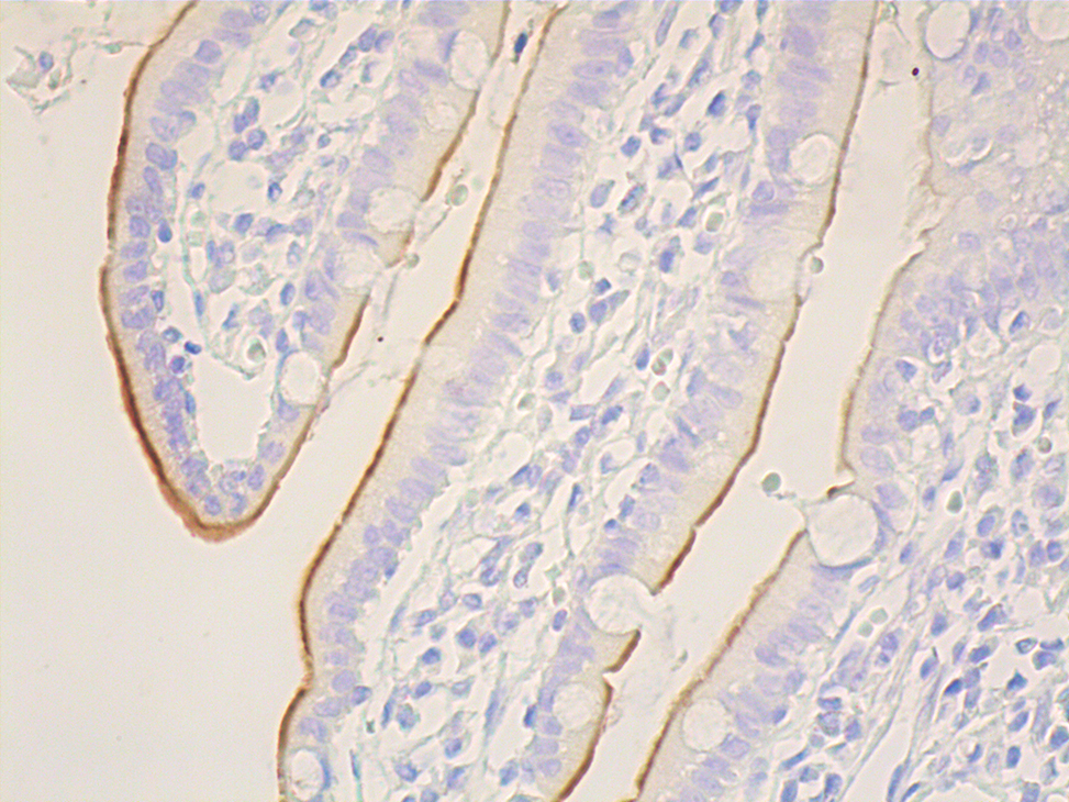 CD10 Antibody (F-4) | SCBT - Santa Cruz Biotechnology