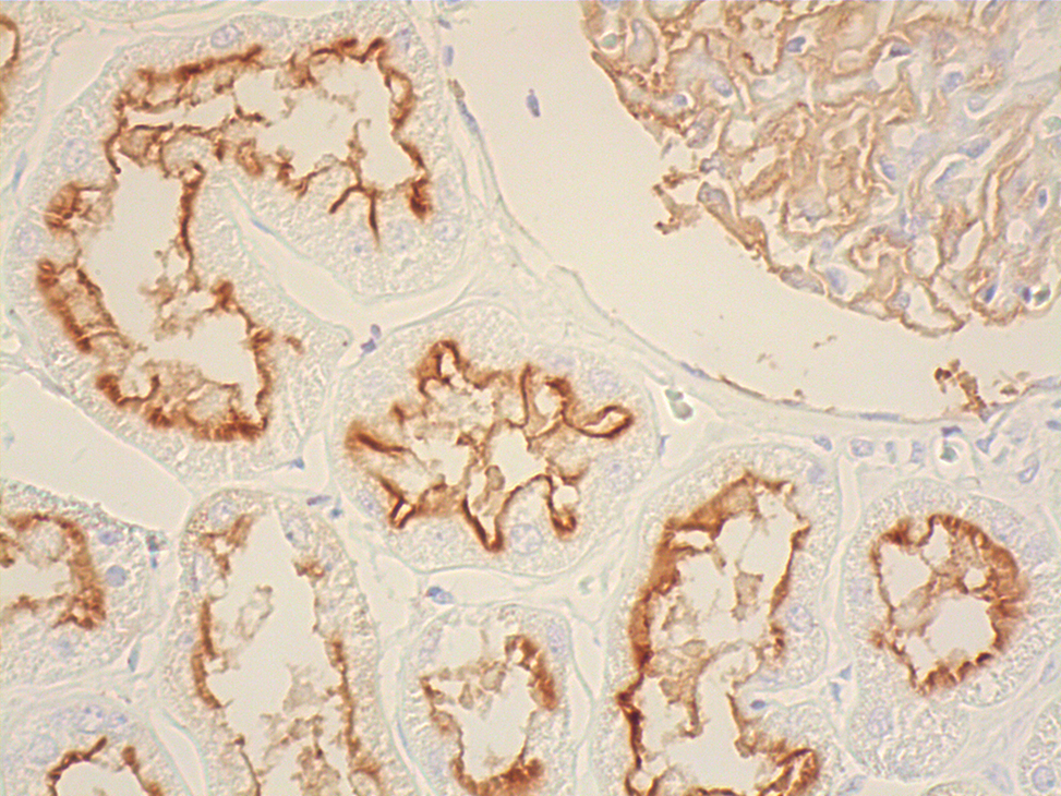 Maichan CD10枚 CD10 Antibody (F-4) | SCBT - Santa Cruz Biotechnology
