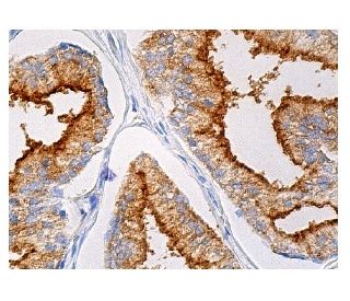 CD13 Antibody (H-8) | SCBT - Santa Cruz Biotechnology