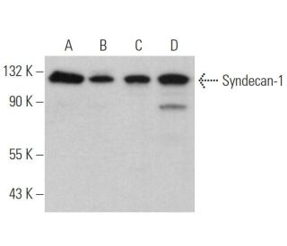 CD138/SDC1/Syndecan-1 Antibody (DL-101) - Western Blotting - Image 361035The Double Nickase Plasmid features a U6 promoter for sgRNA expression, a 20 nt targeting sequence, and a gRNA scaffold to guide Cas9n. It includes a CBh promoter for Cas9n (D10A) and puromycin resistance, GFP for transfection verification, and nuclear localization signals (NLS). The 2A peptide allows co-expression of Cas9n and Puro from a single promoter, enabling precise genome editing with reduced off-target effects. 