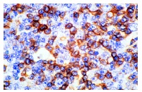 cd14-antibody-uch-m1-