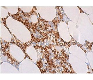 CD15 Antibody (C3D-1) | SCBT - Santa Cruz Biotechnology