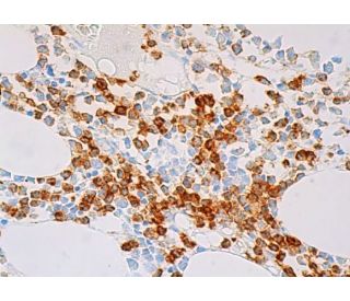 CD15 Antibody (HI98) | SCBT - Santa Cruz Biotechnology