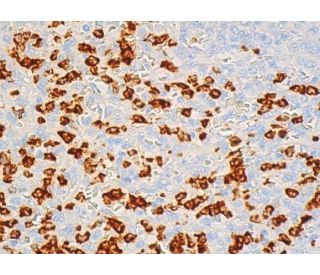 CD15 Antibody (HI98) | SCBT - Santa Cruz Biotechnology