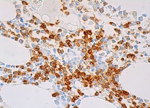 cd15-antibody-hi98-
