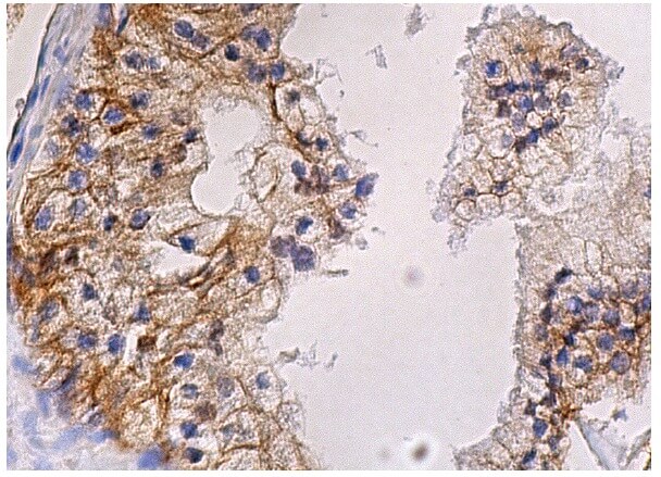 CD151 Antibody (H-8) | SCBT - Santa Cruz Biotechnology