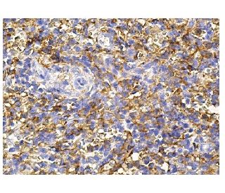 CD16 Antibody (DJ130c) - Immunohistochemistry - Image 156511 
