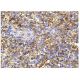 This polyclonal antibody has been discontinued. See our recommended <a href="cd16-antibody-dj130c">CD16 (DJ130c)</a> monoclonal antibody (sample data shown). immunohistochemistry image from recommended CD16 (DJ130c) monoclonal antibody replacement. Image 156511
