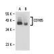 CD165 Antibody (3H1924) - Western Blotting - Image 18105 