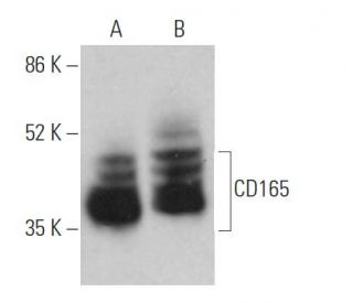 CD165 Antibody (3H1924) - Western Blotting - Image 370120 