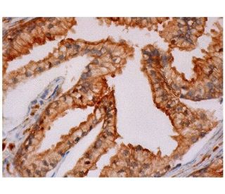 CD177 Antibody (C-5) | SCBT - Santa Cruz Biotechnology
