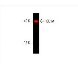 CD1A Antibody (CTB6) - Western Blotting - Image 392435