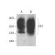 CD2 Antibody (RM2-5) - Western Blotting - Image 381351 