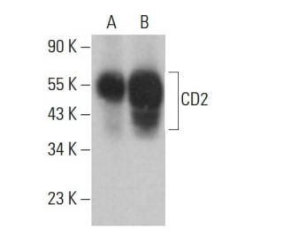CD2 Antibody (TS2/18.1.1) - Western Blotting - Image 381352 