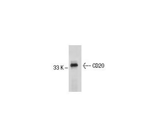 CD20 Antibody (AT80) - Western Blotting - Image 59185