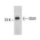CD20 Antibody (AT80) - Western Blotting - Image 59185