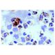 CD20 Antibody (B-LY1) - Immunohistochemistry - Image 4764 