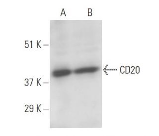 CD20 Antibody (B-LY1) | SCBT - Santa Cruz Biotechnology