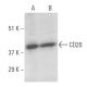 CD20 Antibody (B-LY1) - Western Blotting - Image 11035 