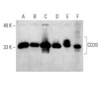 western blotting image from recommended CD20 (D-10) monoclonal antibody replacement. Image 368014