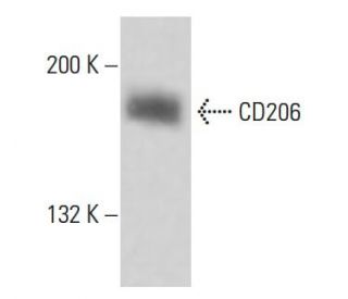 CD206/Mannose Receptor/MMR Antibody (3H1994) - Western Blotting - Image 18115
