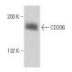 CD206/Mannose Receptor/MMR Antibody (3H1994) - Western Blotting - Image 18115
