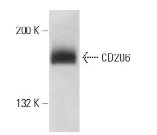 CD206/Mannose Receptor/MMR Antibody (6A598) - Western Blotting - Image 18114