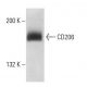 CD206/Mannose Receptor/MMR Antibody (6A598) - Western Blotting - Image 18114